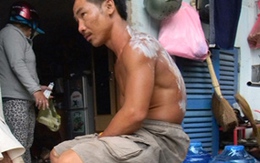 Xì bình gas, 5 người bị bỏng