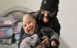 Chuyện thương tâm về những người chỉ có nửa đầu
