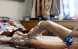 Nhập viện vì... tự kéo dài chân