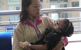Tình cảnh đáng thương của bé 5 tuổi ngã vào bếp lửa
