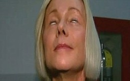 Không thể nhắm mắt sau ca thẩm mỹ