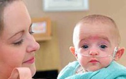 Sống sót kỳ kiệu của bé gái nặng hơn 3 lạng
