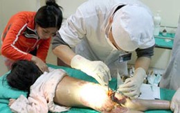 Suýt chết vì chữa bỏng lang băm