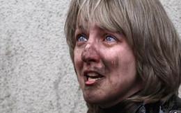 Belarus: Nổ lớn tại nhà ga tàu điện ngầm, gần 140 thương vong
