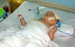 Bé trai 10 tháng tuổi bị cha ném vỡ sọ