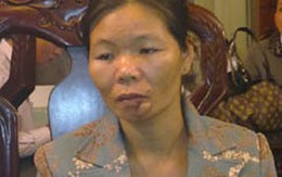 Một phụ nữ bị đánh, cắt môi và cằm