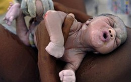 Phóng sự ảnh đoạt giải Pulitzer 2011 làm rung động lòng người