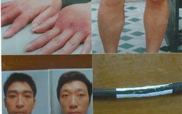 Giải cứu một phụ nữ bị tra tấn dã man