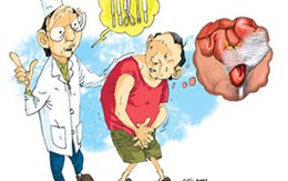 Coi chừng chết vì các bệnh thoát vị 