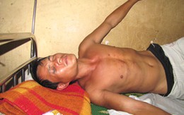 Đánh người dã man vì nghi ăn trộm quặng