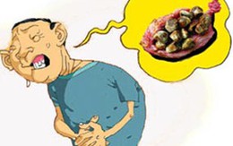 Sỏi mật và những biến chứng không thể xem thường