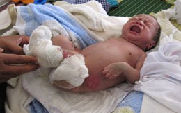 Kỳ tích sống của bé gái bị bố mẹ đốt, chôn sống