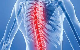 Cách nhận biết lao cột sống