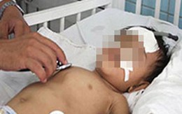 Cha mẹ đánh nhau, con "sứt đầu mẻ trán"