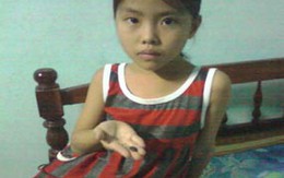 Hạt mãng cầu nằm trong cổ họng hơn 2 năm