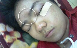 Bảo vệ toà nhà đánh học sinh nhập viện