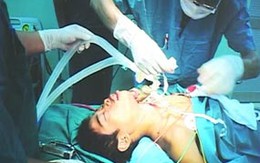 Cứu bệnh nhân bị nhành cây đâm xuyên lưỡi