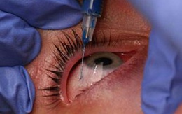 Rùng mình với dịch vụ làm đẹp mới: Xăm cầu mắt