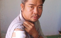 Giận con, chém công an