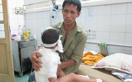An toàn cho trẻ trong ngày hè (2): Ngừa tai nạn bỏng