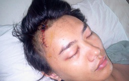 Ca sĩ Tuấn Khanh bị đánh vỡ sọ: Do băng nhóm đòi “bảo kê”?