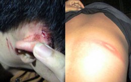 Những kiểu hành xử côn đồ của bảo vệ