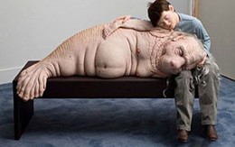 Sửng sốt với chùm ảnh "người lợn" 