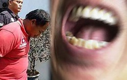 Hầu tòa vì cắn bị thương vợ khi ‘quan hệ’
