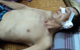 Vụ truy sát dã man, 3 cảnh sát nhập viện qua lời nhân chứng