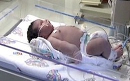 Bé sơ sinh "khổng lồ" gần 7,3kg 