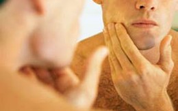 Cách kiểm tra nốt ruồi của bạn lành hay ác tính