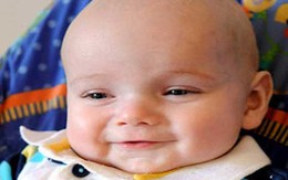 Một bé trai được 'sắp xếp' lại hộp sọ