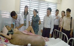 Hội chẩn liên bệnh viện ca khối u nặng 80 kg