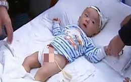 Đi chơi công viên, một bé trai bị khỉ cắn ‘của quý’