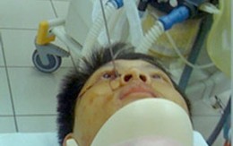 Bị kiếm đâm sâu vào mắt 9,5 cm vẫn sống