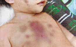 Tra tấn con gái vì khóc khi mẹ đang “mây mưa”
