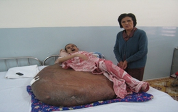 Ước mơ của bệnh nhân mang khối u 80 kg