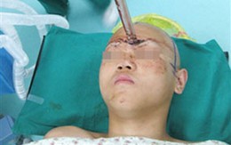 Kiếm đâm giữa trán thiếu niên 15 tuổi