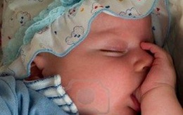 Bé bị nhiễm trùng máu vì… mút tay