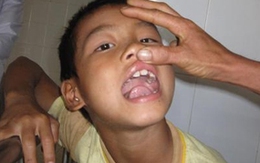 Cháu bé 9 tuổi bị đánh vì một con chim