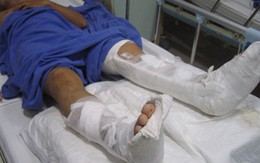 Người đàn ông bị côn đồ chặt gần đứt chân