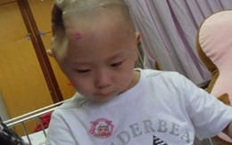Mẹ kế bị tố dùng xẻng đánh lõm đầu con trai 4 tuổi