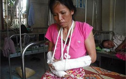 Bị chồng đánh bầm dập vì... "chuyện ấy"