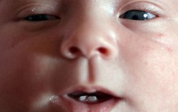 Bé gái chào đời cười tươi với 2 răng cửa