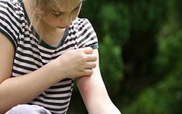 Mẹo tránh muỗi cắn khi đi du lịch 