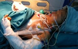 Em bé trong vụ thảm án tiệm vàng qua nguy kịch