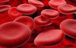 Cẩn trọng với bệnh Hemophilia B
