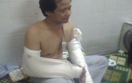 Đánh chồng cũ để đòi nợ... vợ cũ