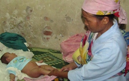 Bé 2 tháng tuổi mất dương vật vì chó cắn