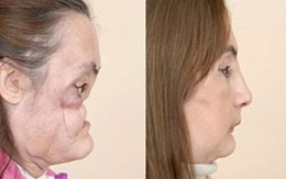 Nỗi đau người đàn bà có mặt quỷ 